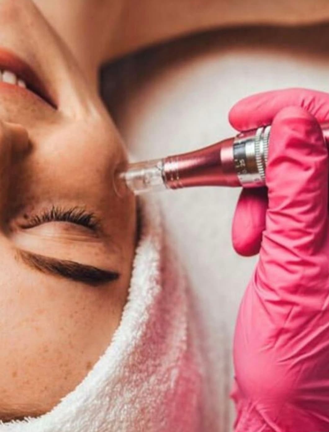 Microneedling cu Seruri